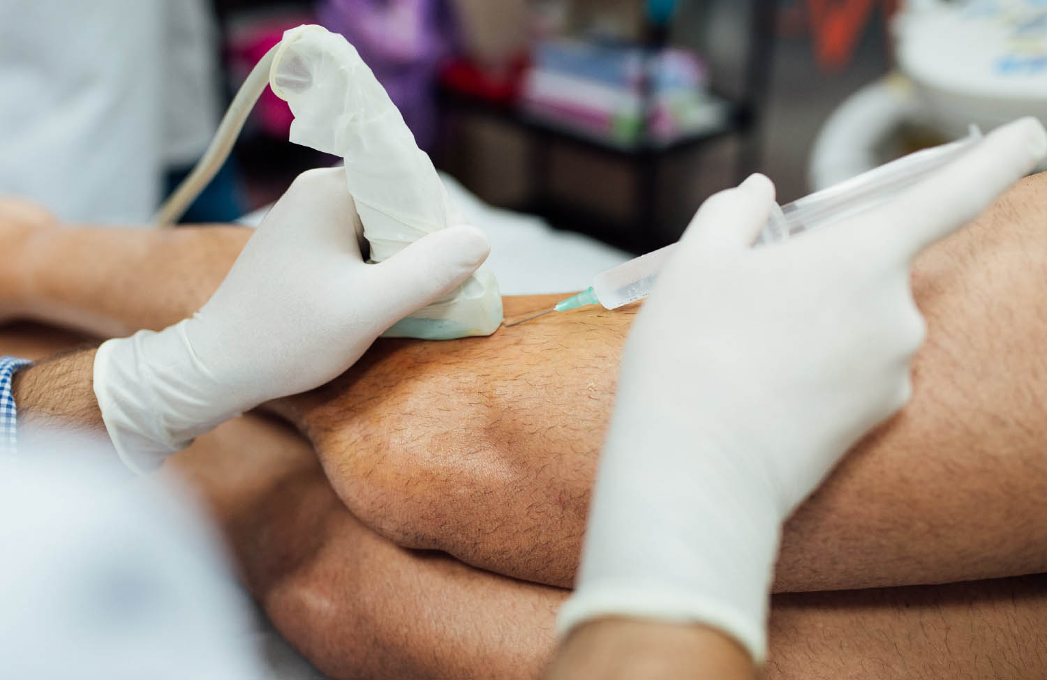 Procedimiento de bloqueo nervioso percutáneo con guía ecográfica en la rodilla.